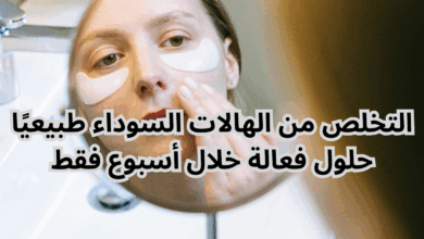 التخلص من الهالات السوداء