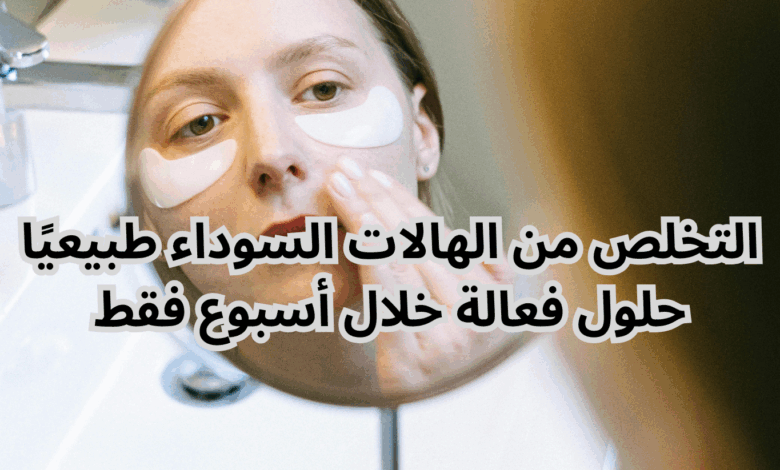 التخلص من الهالات السوداء